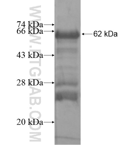 FAM131C fusion protein Ag15392 SDS-PAGE