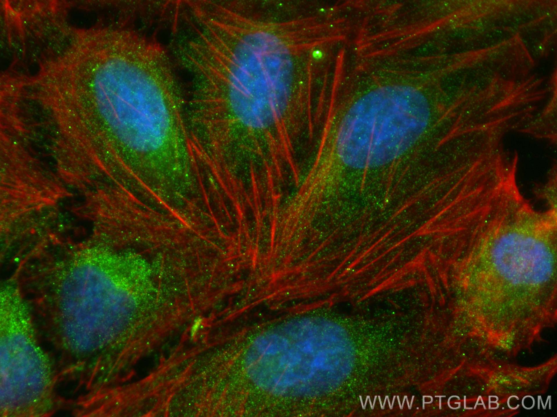 IF Staining of U2OS using 24650-1-AP