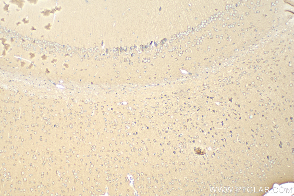 Immunohistochemistry (IHC) staining of mouse brain tissue using FAM134A Polyclonal antibody (24650-1-AP)