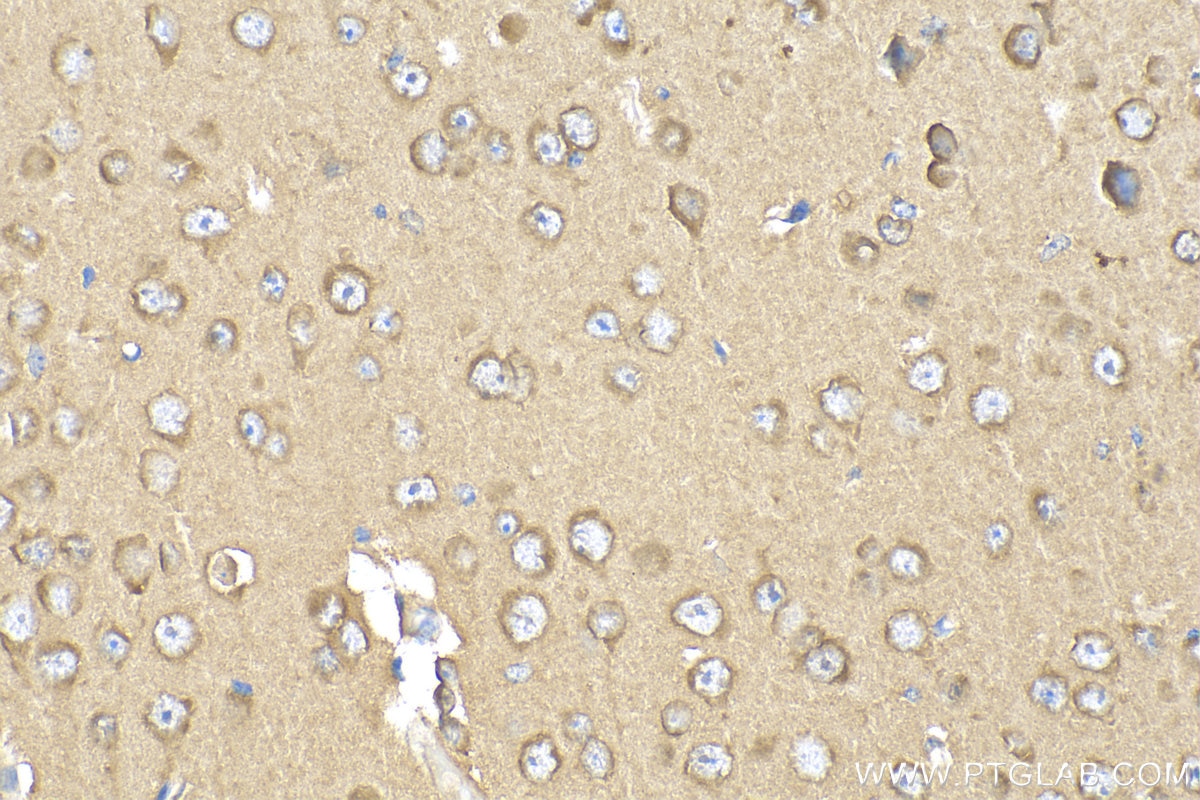 Immunohistochemistry (IHC) staining of mouse brain tissue using FAM134A Polyclonal antibody (24650-1-AP)