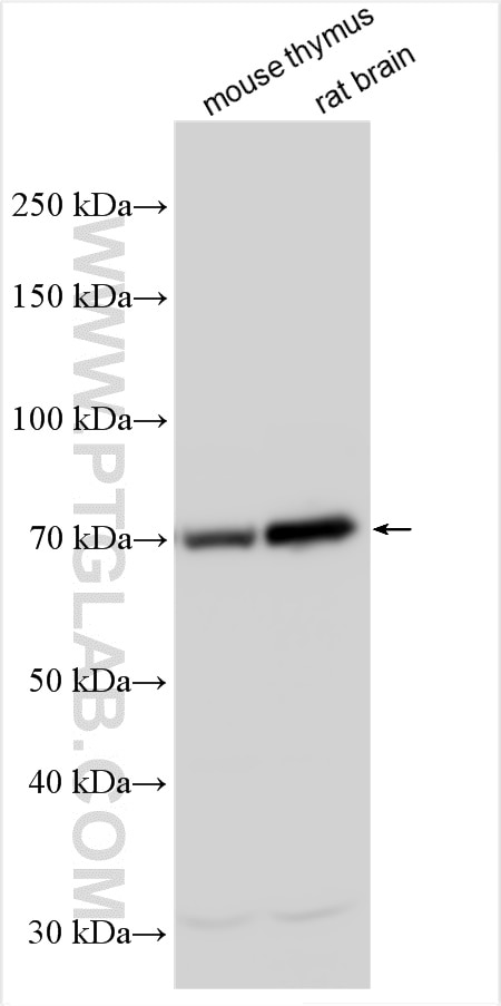 Western Blot (WB) analysis of various lysates using FAM134A Polyclonal antibody (24650-1-AP)