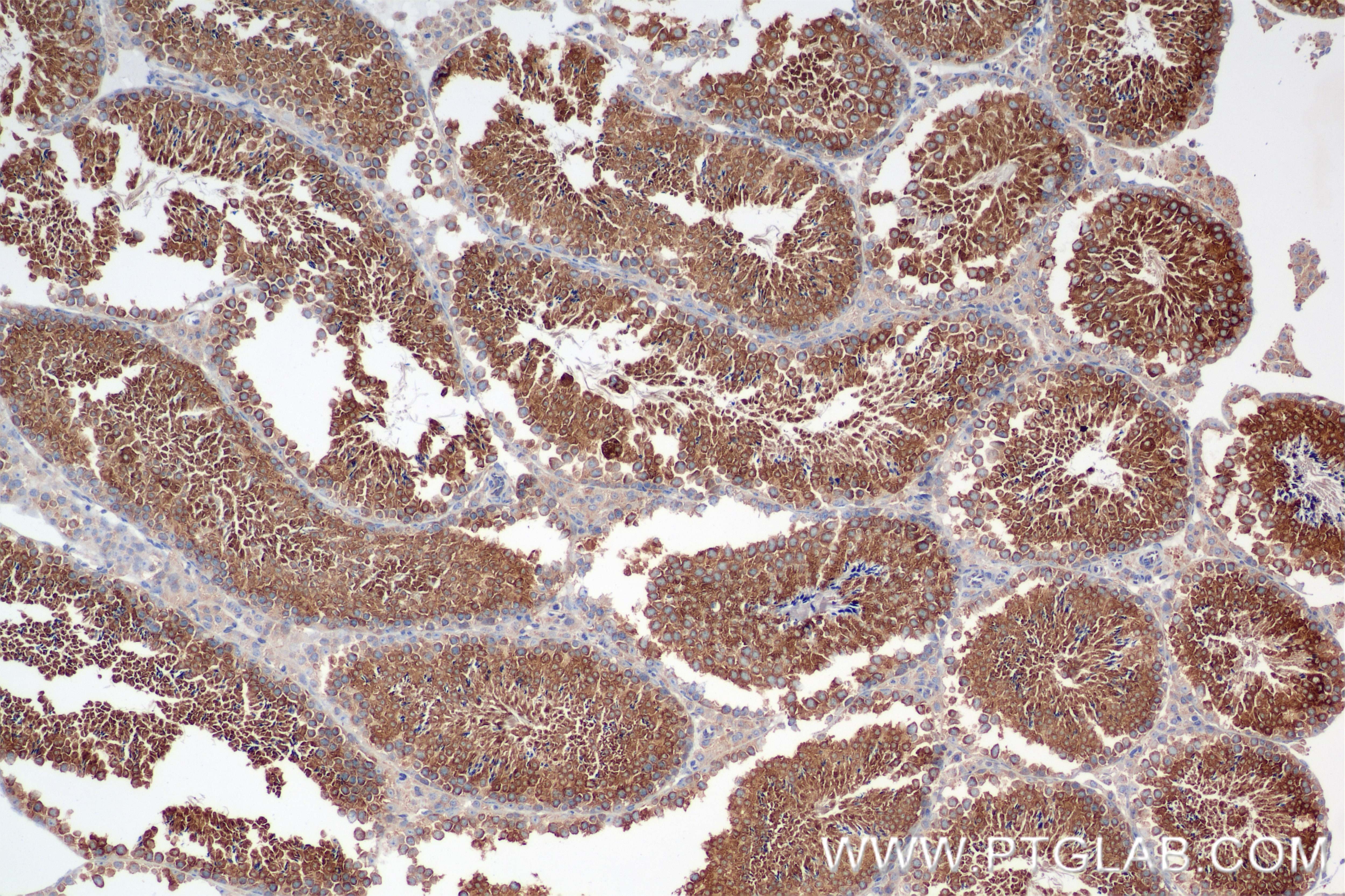 Immunohistochemistry (IHC) staining of mouse testis tissue using FAM134A Recombinant antibody (85791-4-RR)