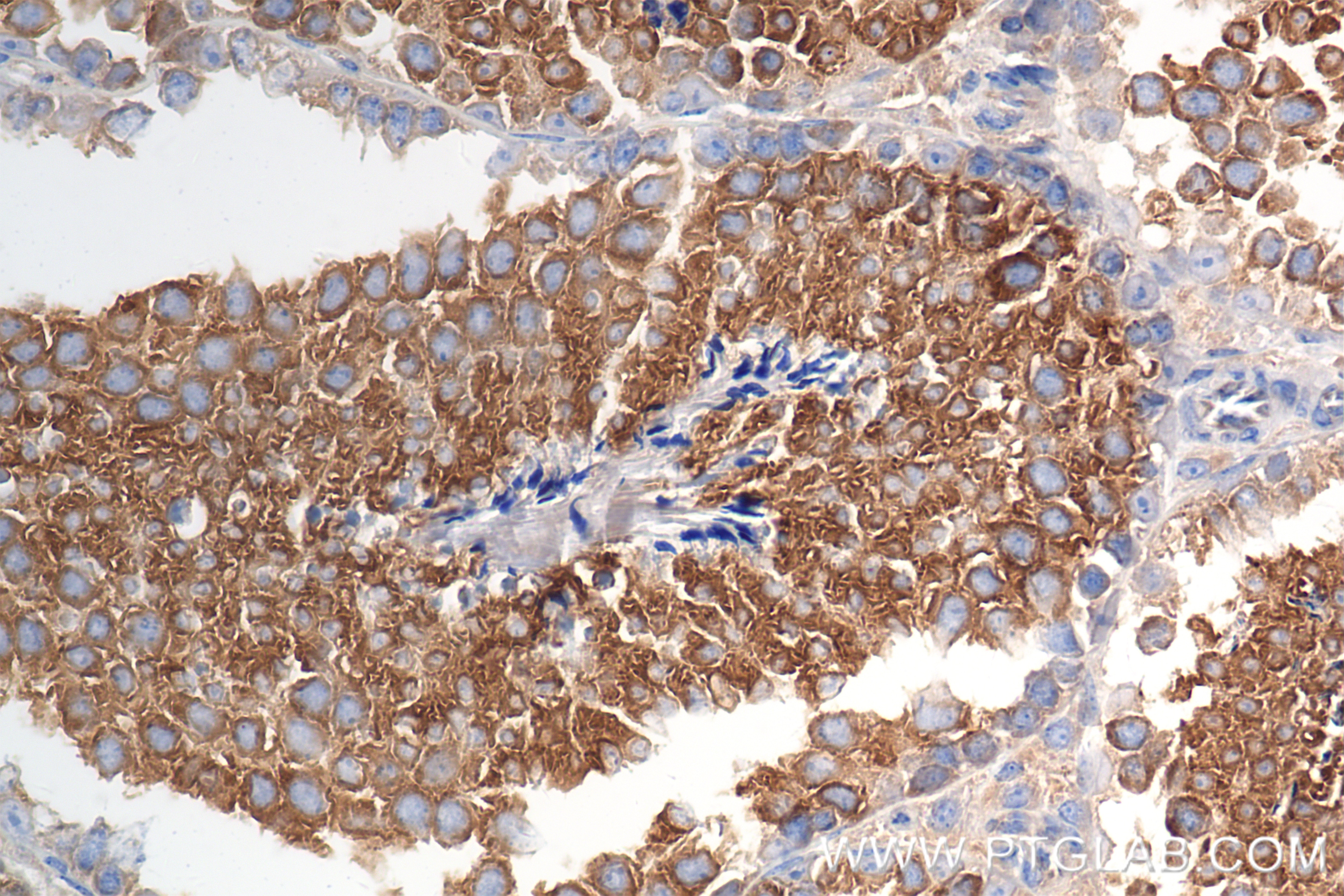 Immunohistochemistry (IHC) staining of mouse testis tissue using FAM134A Recombinant antibody (85791-4-RR)