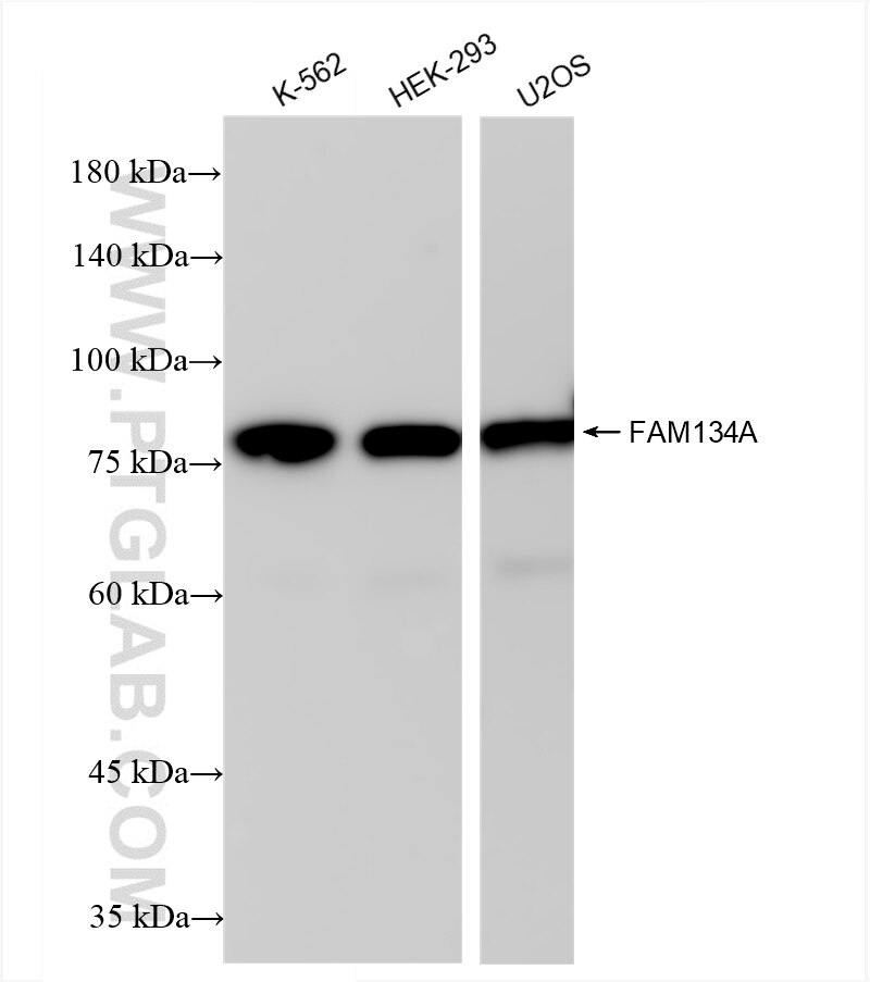 Western Blot (WB) analysis of various lysates using FAM134A Recombinant antibody (85791-4-RR)