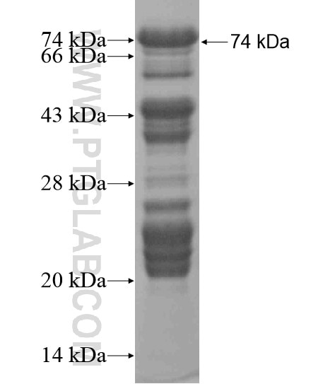 FAM134A fusion protein Ag20025 SDS-PAGE