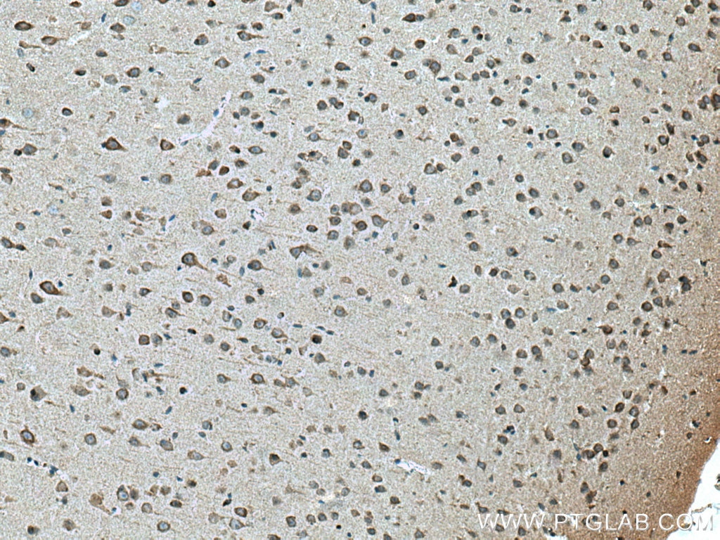 Immunohistochemistry (IHC) staining of mouse brain tissue using FAM134B Polyclonal antibody (21537-1-AP)