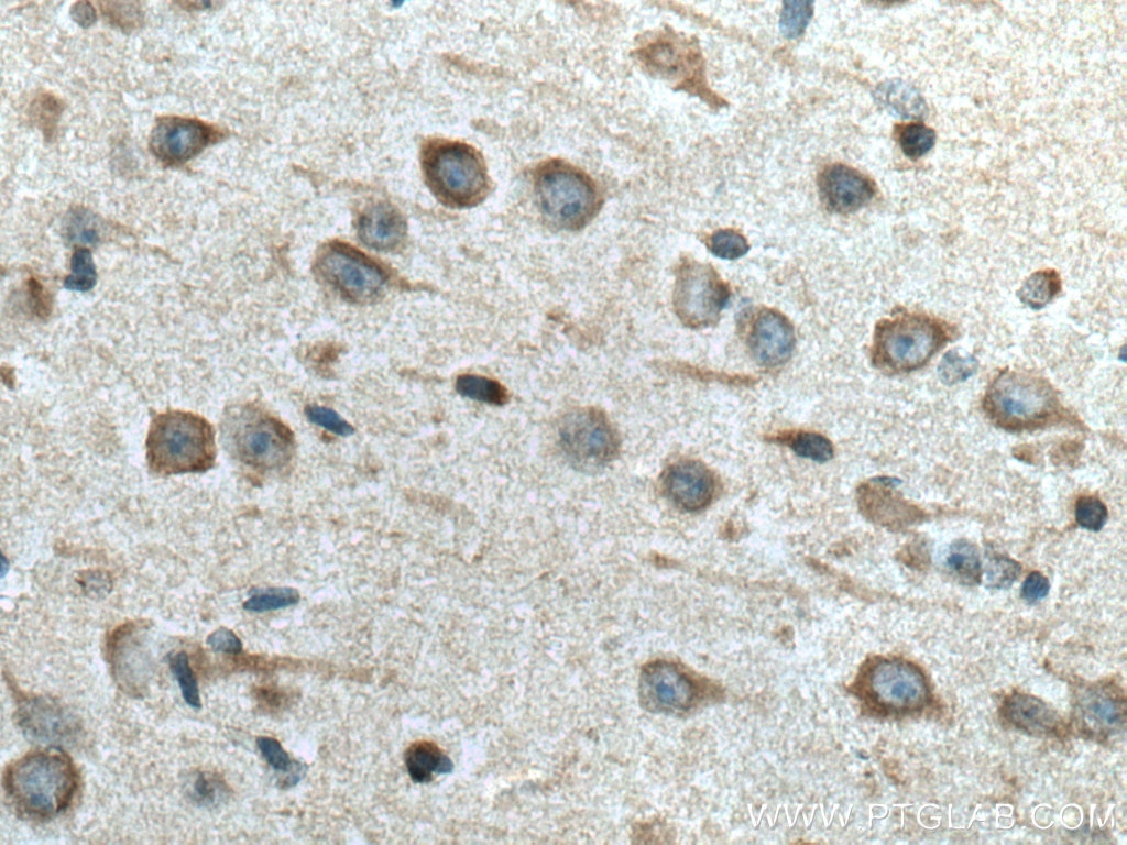 Immunohistochemistry (IHC) staining of mouse brain tissue using FAM134B Polyclonal antibody (21537-1-AP)