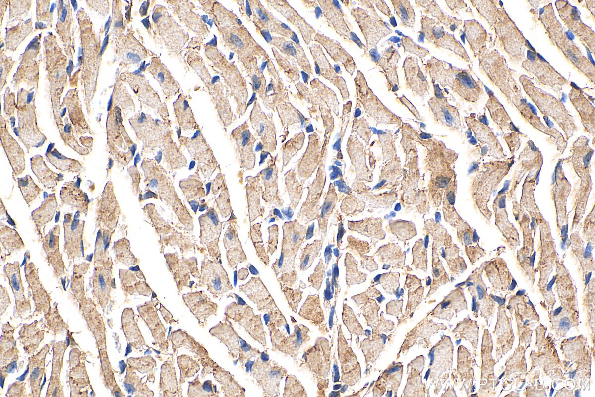 Immunohistochemistry (IHC) staining of mouse heart tissue using FAM134B Polyclonal antibody (21537-1-AP)