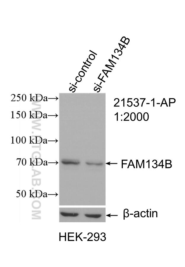 Western Blot (WB) analysis of HEK-293 cells using FAM134B Polyclonal antibody (21537-1-AP)