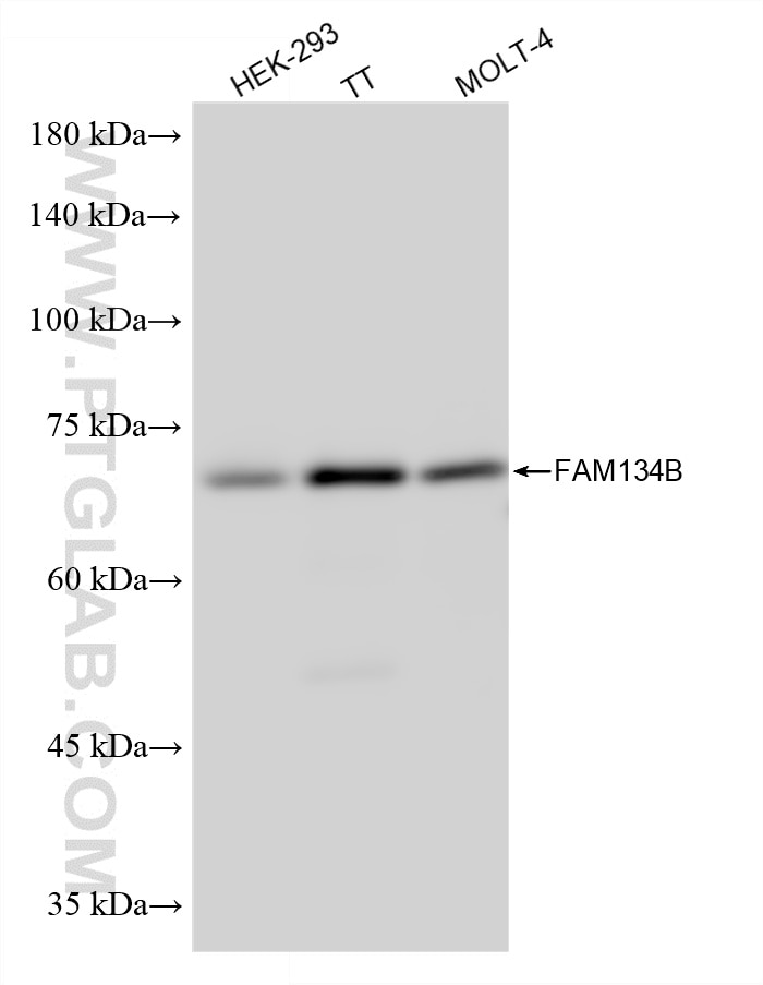 Western Blot (WB) analysis of various lysates using FAM134B Recombinant monoclonal antibody (84773-3-RR)