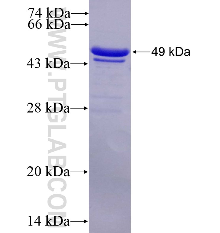FAM134B fusion protein Ag16176 SDS-PAGE