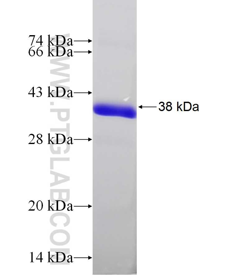 FAM134B fusion protein Ag16178 SDS-PAGE