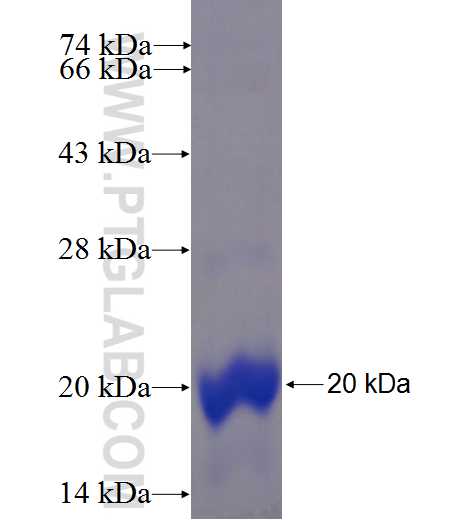 FAM134C fusion protein Ag23790 SDS-PAGE