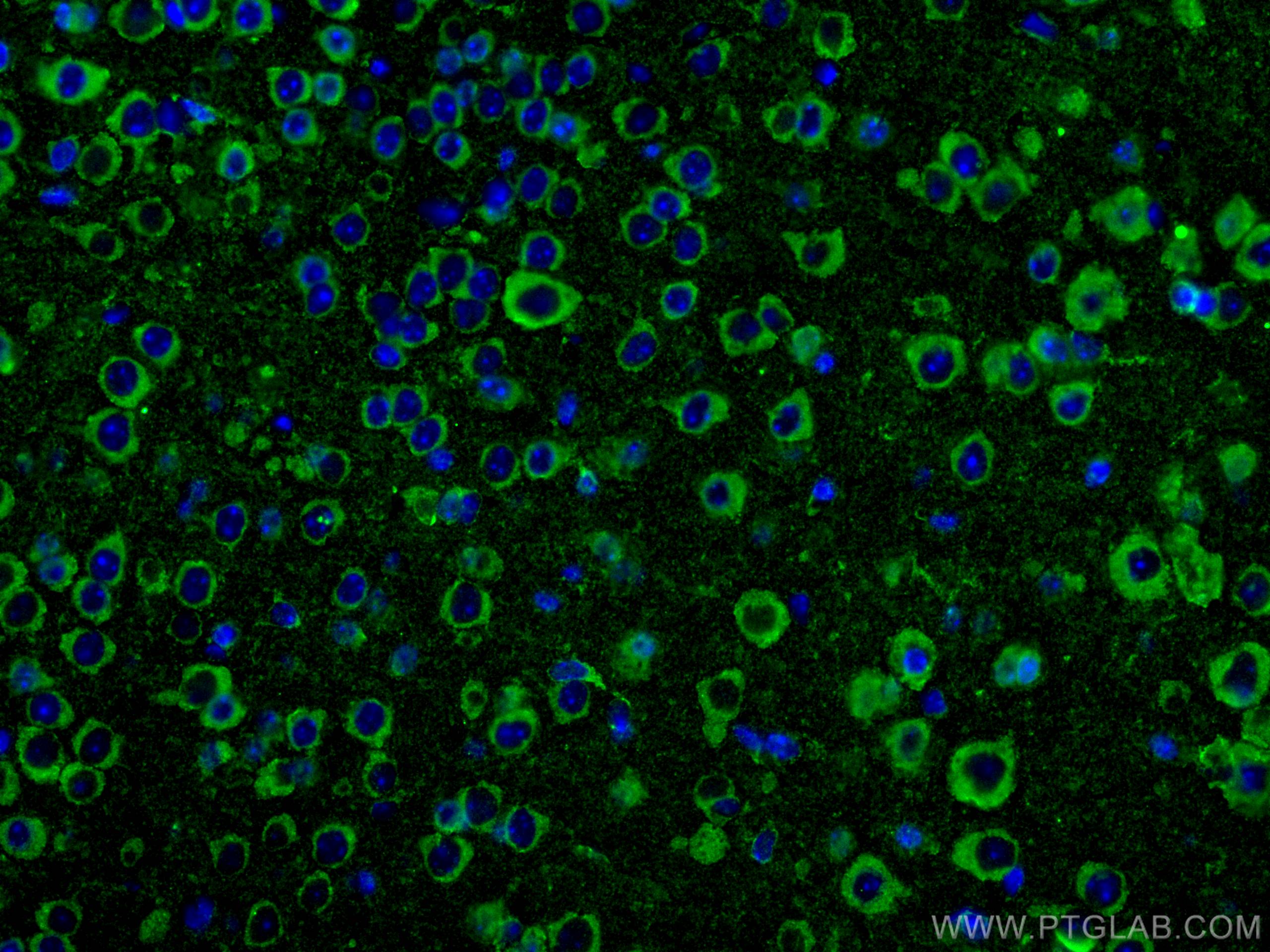 Immunofluorescence (IF) / fluorescent staining of mouse brain tissue using FAM135B Polyclonal antibody (28061-1-AP)
