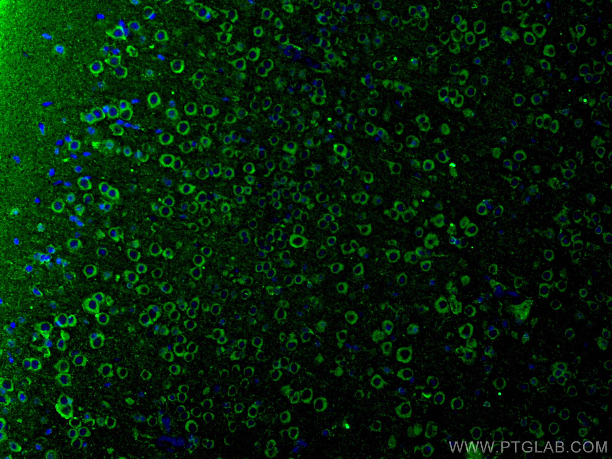 Immunofluorescence (IF) / fluorescent staining of mouse brain tissue using FAM135B Polyclonal antibody (28061-1-AP)