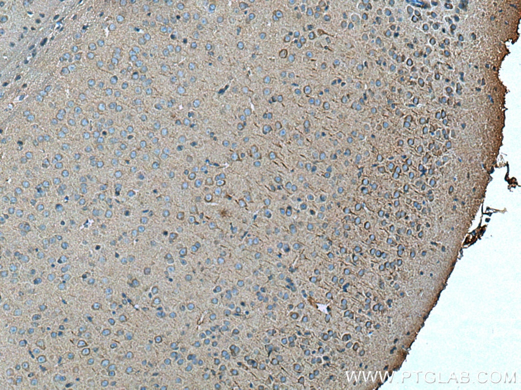 Immunohistochemistry (IHC) staining of mouse brain tissue using FAM135B Polyclonal antibody (28061-1-AP)