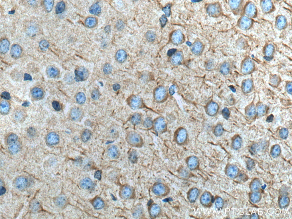 Immunohistochemistry (IHC) staining of mouse brain tissue using FAM135B Polyclonal antibody (28061-1-AP)