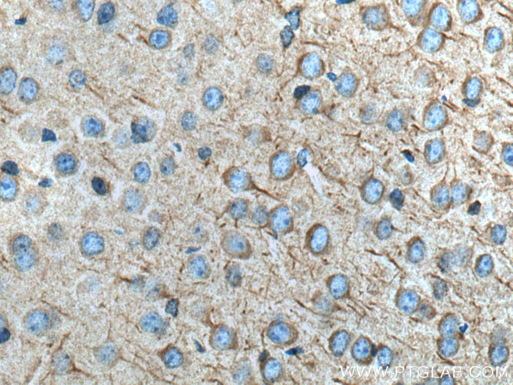 Immunohistochemistry (IHC) staining of mouse brain tissue using FAM135B Polyclonal antibody (28061-1-AP)