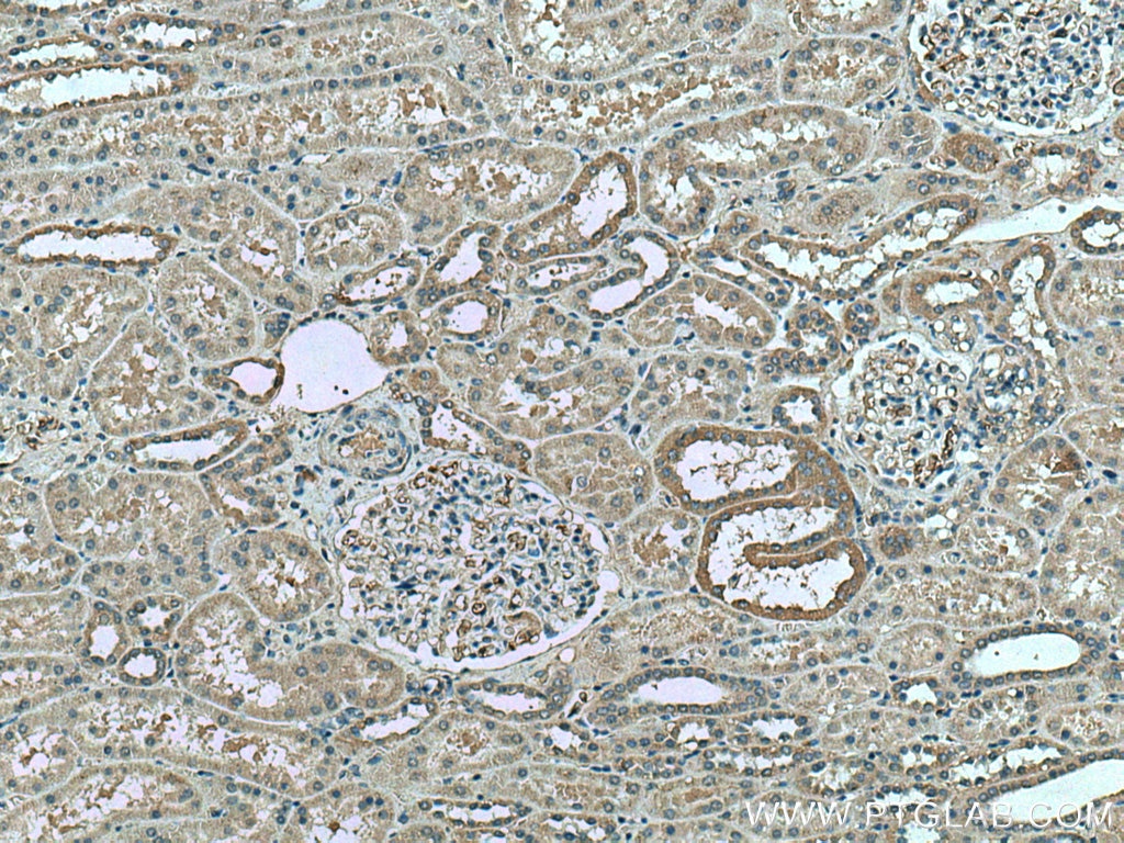 Immunohistochemistry (IHC) staining of human kidney tissue using FAM135B Polyclonal antibody (28061-1-AP)