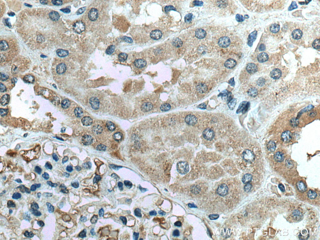 Immunohistochemistry (IHC) staining of human kidney tissue using FAM135B Polyclonal antibody (28061-1-AP)