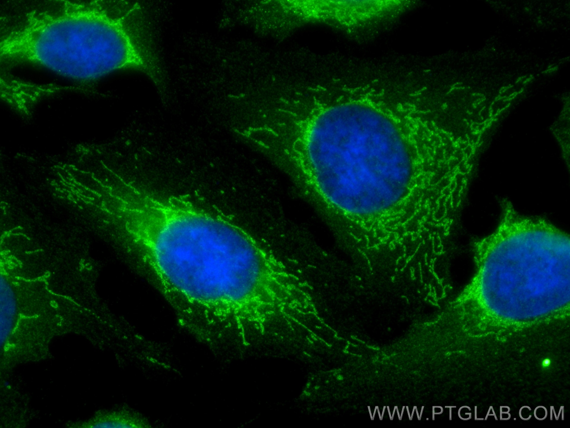 Immunofluorescence (IF) / fluorescent staining of U2OS cells using FAM136A Polyclonal antibody (30845-1-AP)