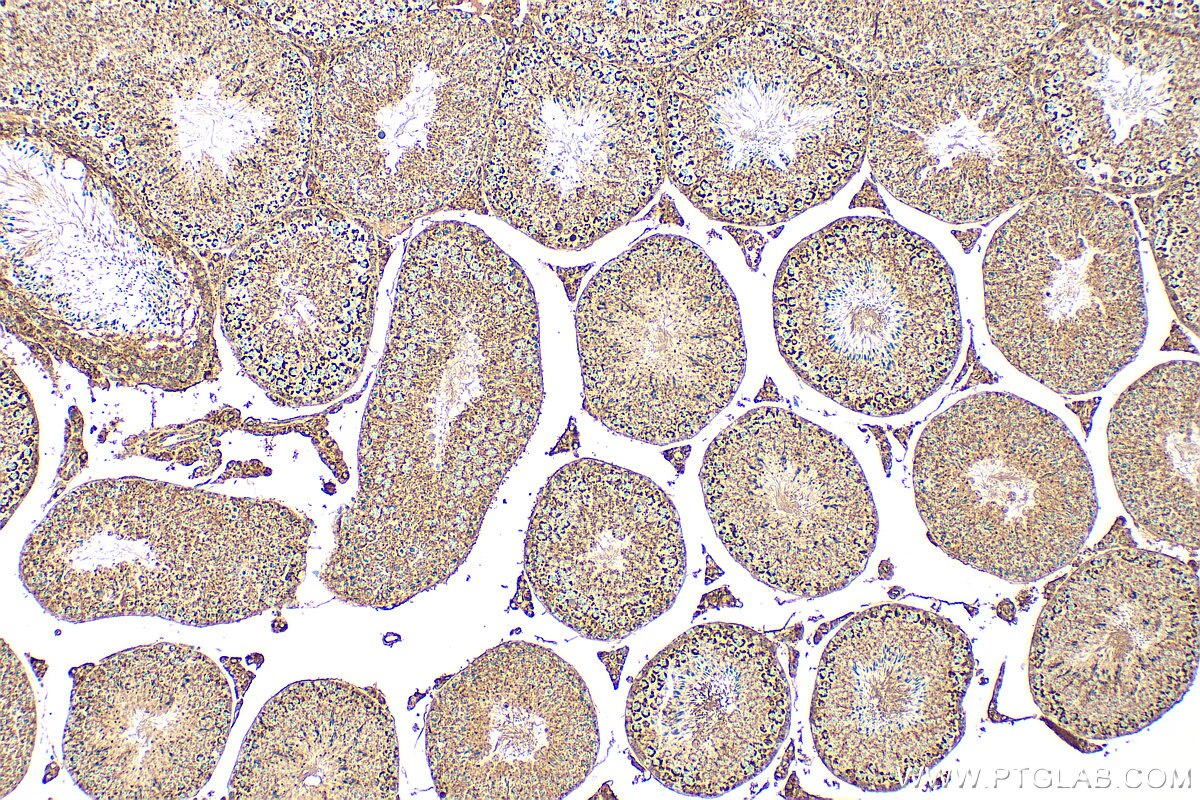Immunohistochemistry (IHC) staining of mouse testis tissue using FAM136A Polyclonal antibody (30845-1-AP)