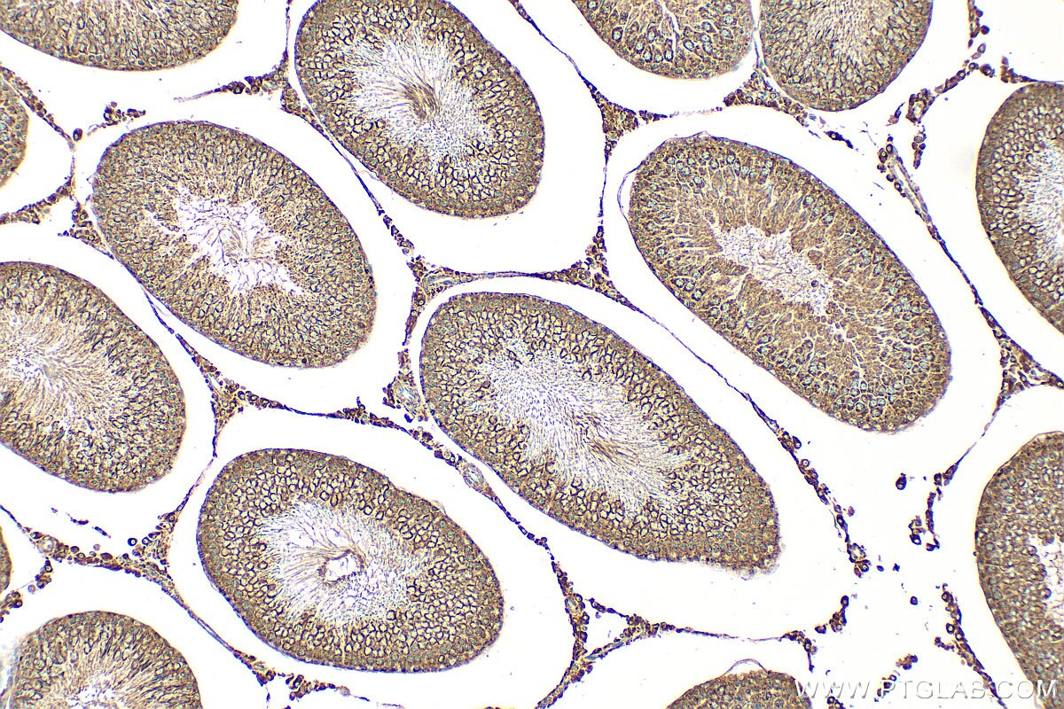 Immunohistochemistry (IHC) staining of rat testis tissue using FAM136A Polyclonal antibody (30845-1-AP)