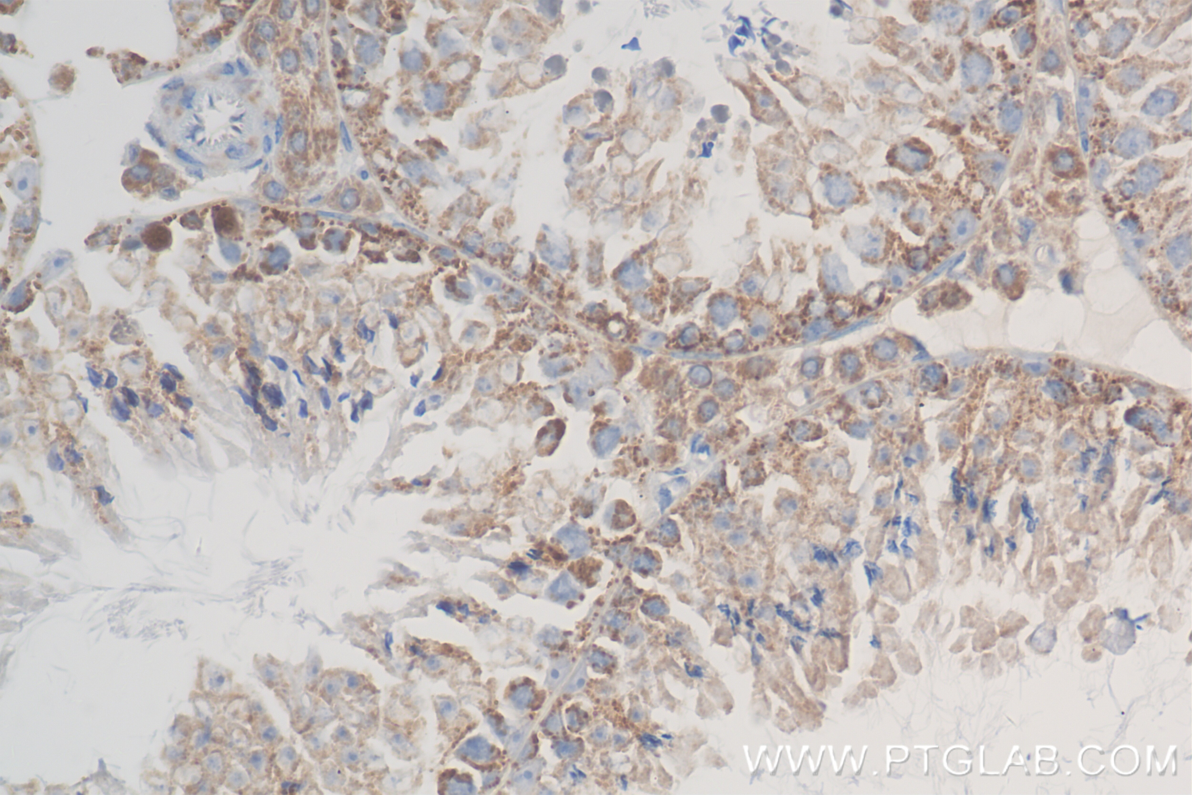 Immunohistochemistry (IHC) staining of mouse testis tissue using FAM136A Recombinant antibody (84150-2-RR)