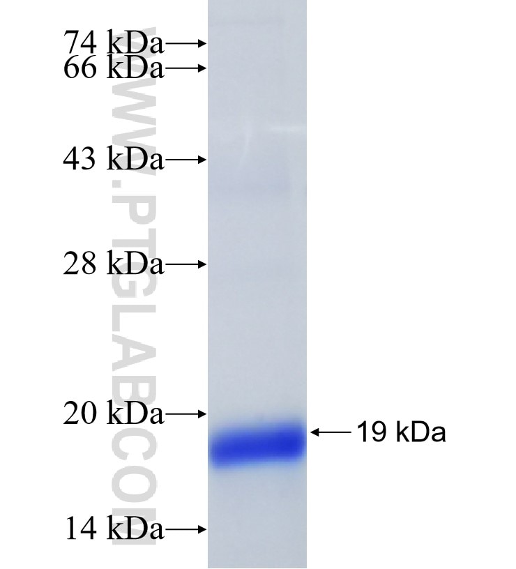 FAM136A fusion protein Ag35049 SDS-PAGE FAM136A fusion protein Ag35049 SDS-PAGE