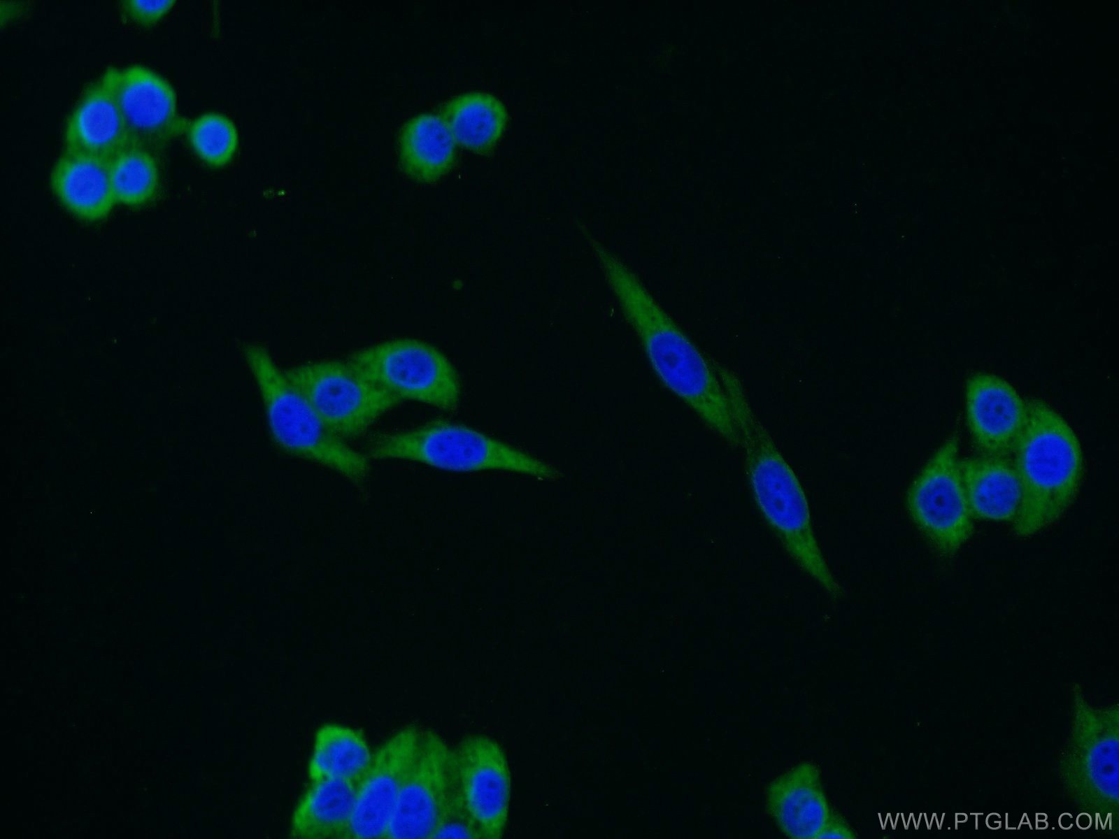 Immunofluorescence (IF) / fluorescent staining of HeLa cells using FAM13A Polyclonal antibody (55401-1-AP)