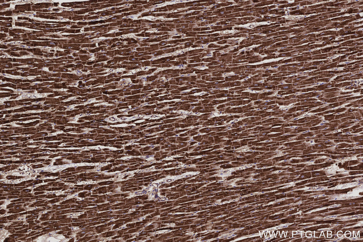 Immunohistochemistry (IHC) staining of human heart tissue using FAM13A Polyclonal antibody (55401-1-AP)