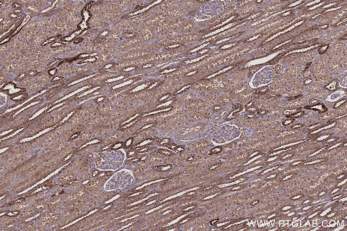 Immunohistochemistry (IHC) staining of human kidney tissue using FAM13A Polyclonal antibody (55401-1-AP)