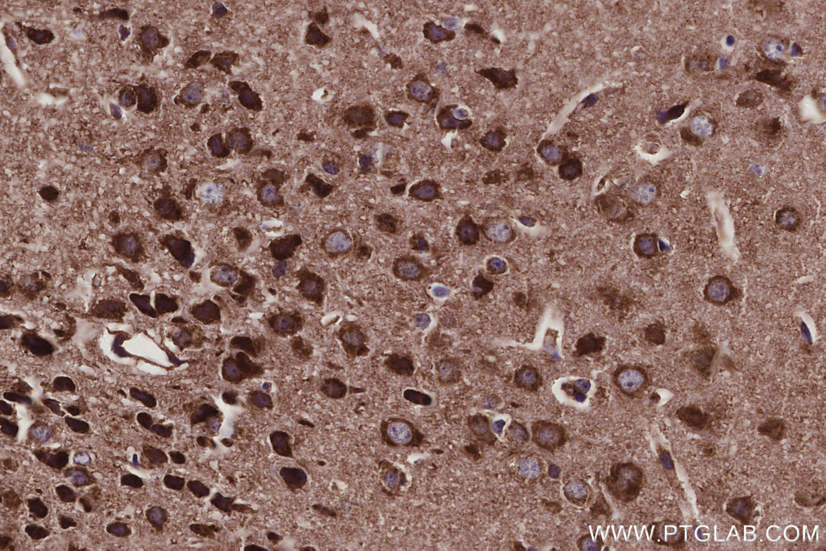 Immunohistochemistry (IHC) staining of mouse brain tissue using FAM13A Polyclonal antibody (55401-1-AP)