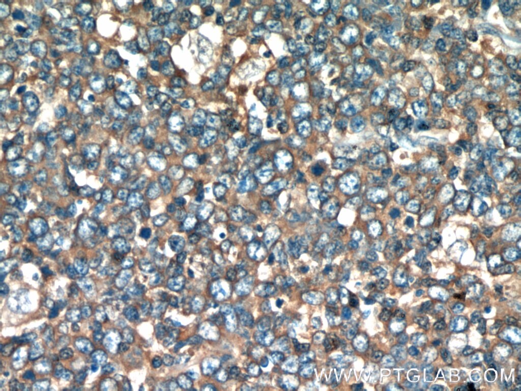 Immunohistochemistry (IHC) staining of human tonsil tissue using FAM13A Polyclonal antibody (55401-1-AP)