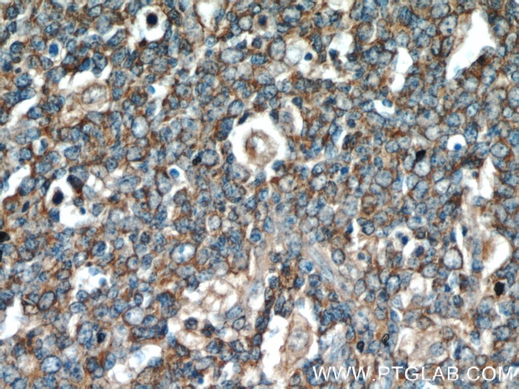Immunohistochemistry (IHC) staining of human tonsil tissue using FAM13A Polyclonal antibody (55401-1-AP)