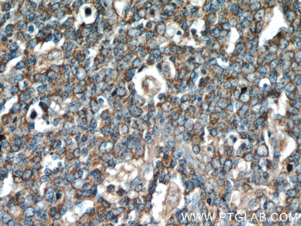 IHC staining of human tonsil using 55401-1-AP