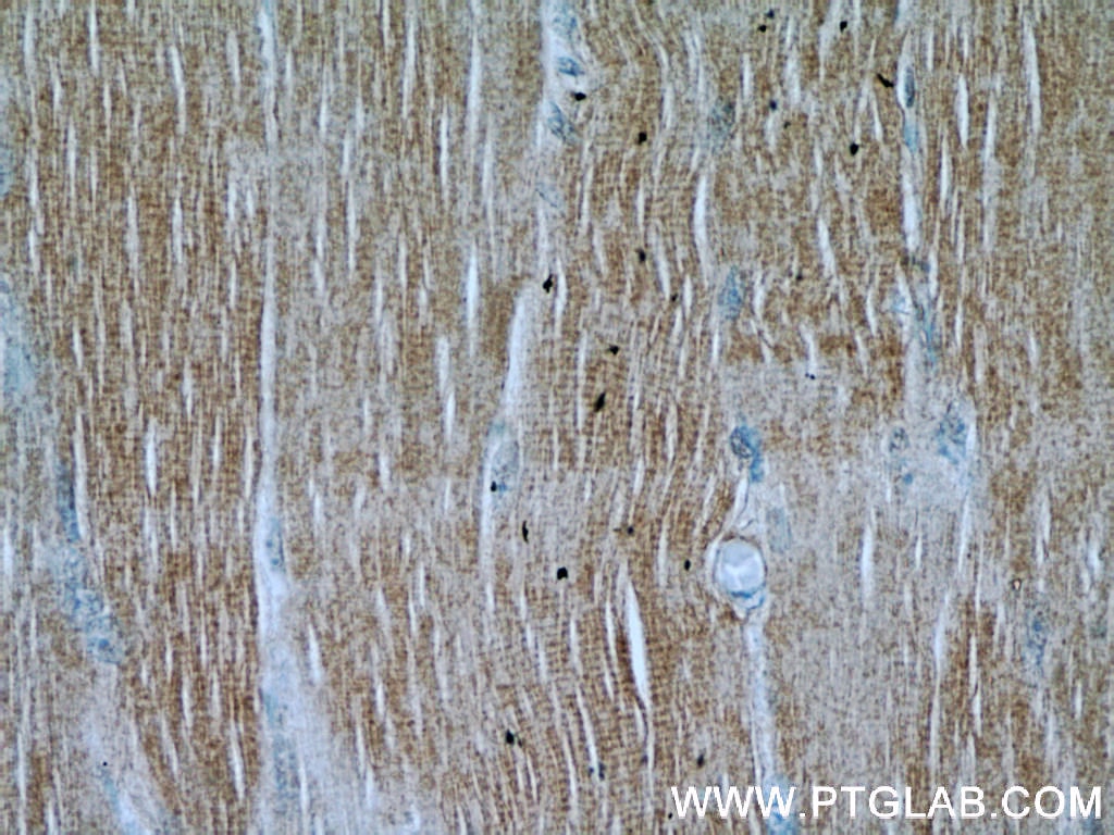 Immunohistochemistry (IHC) staining of human skeletal muscle tissue using FAM13A Polyclonal antibody (55401-1-AP)