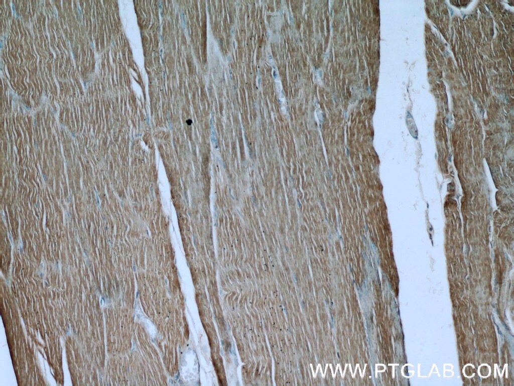 Immunohistochemistry (IHC) staining of human skeletal muscle tissue using FAM13A Polyclonal antibody (55401-1-AP)