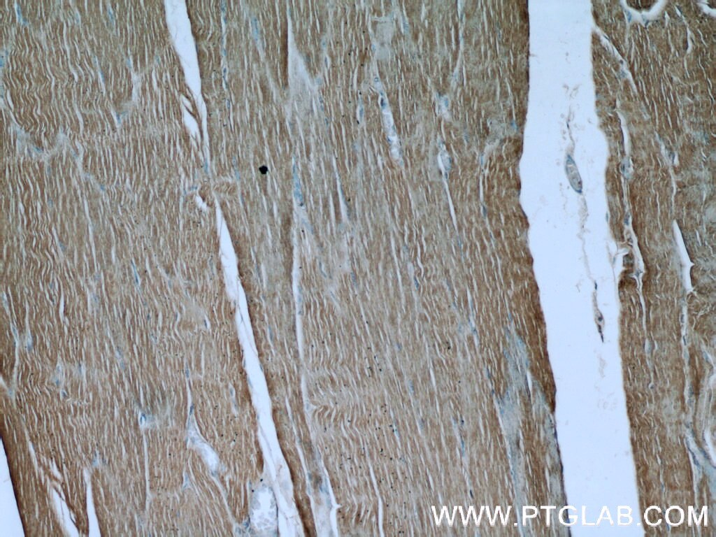 Immunohistochemistry (IHC) staining of human skeletal muscle tissue using FAM13A Polyclonal antibody (55401-1-AP)