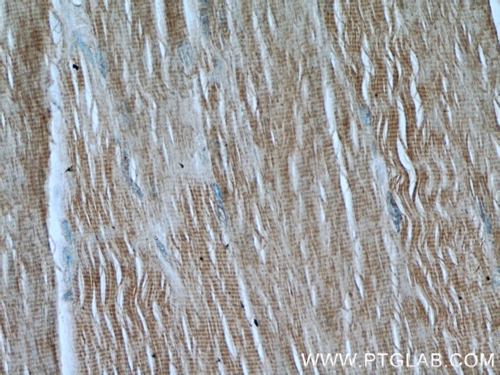 Immunohistochemistry (IHC) staining of human skeletal muscle tissue using FAM13A Polyclonal antibody (55401-1-AP)