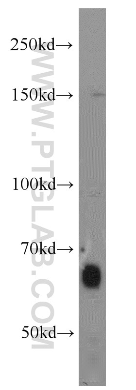 Western Blot (WB) analysis of mouse lung tissue using FAM13A Polyclonal antibody (55401-1-AP)