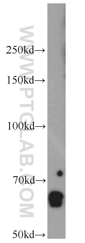 WB analysis of mouse kidney using 55401-1-AP