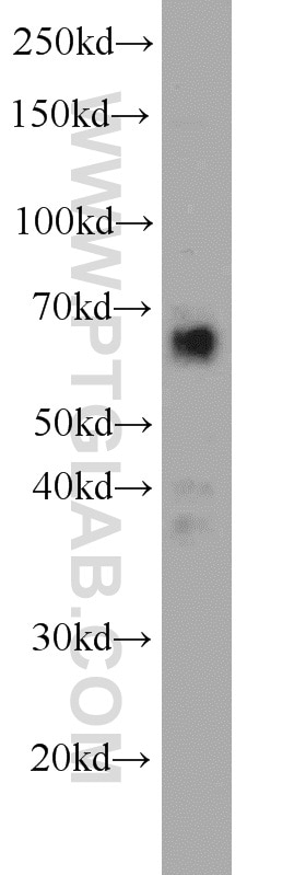 Western Blot (WB) analysis of mouse pancreas tissue using FAM13A Polyclonal antibody (55401-1-AP)