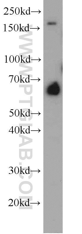 Western Blot (WB) analysis of mouse ovary tissue using FAM13A Polyclonal antibody (55401-1-AP)