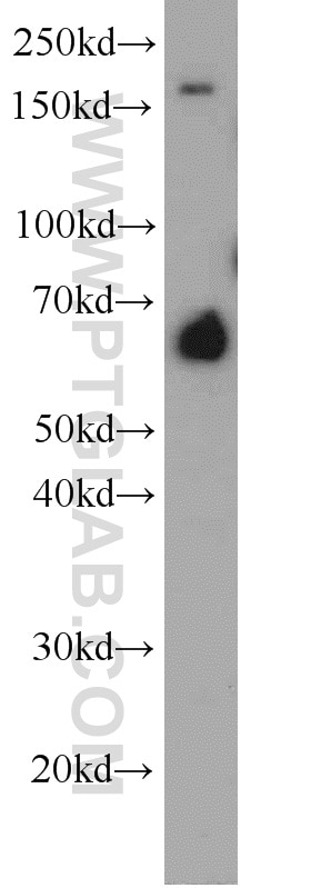 Western Blot (WB) analysis of mouse ovary tissue using FAM13A Polyclonal antibody (55401-1-AP)