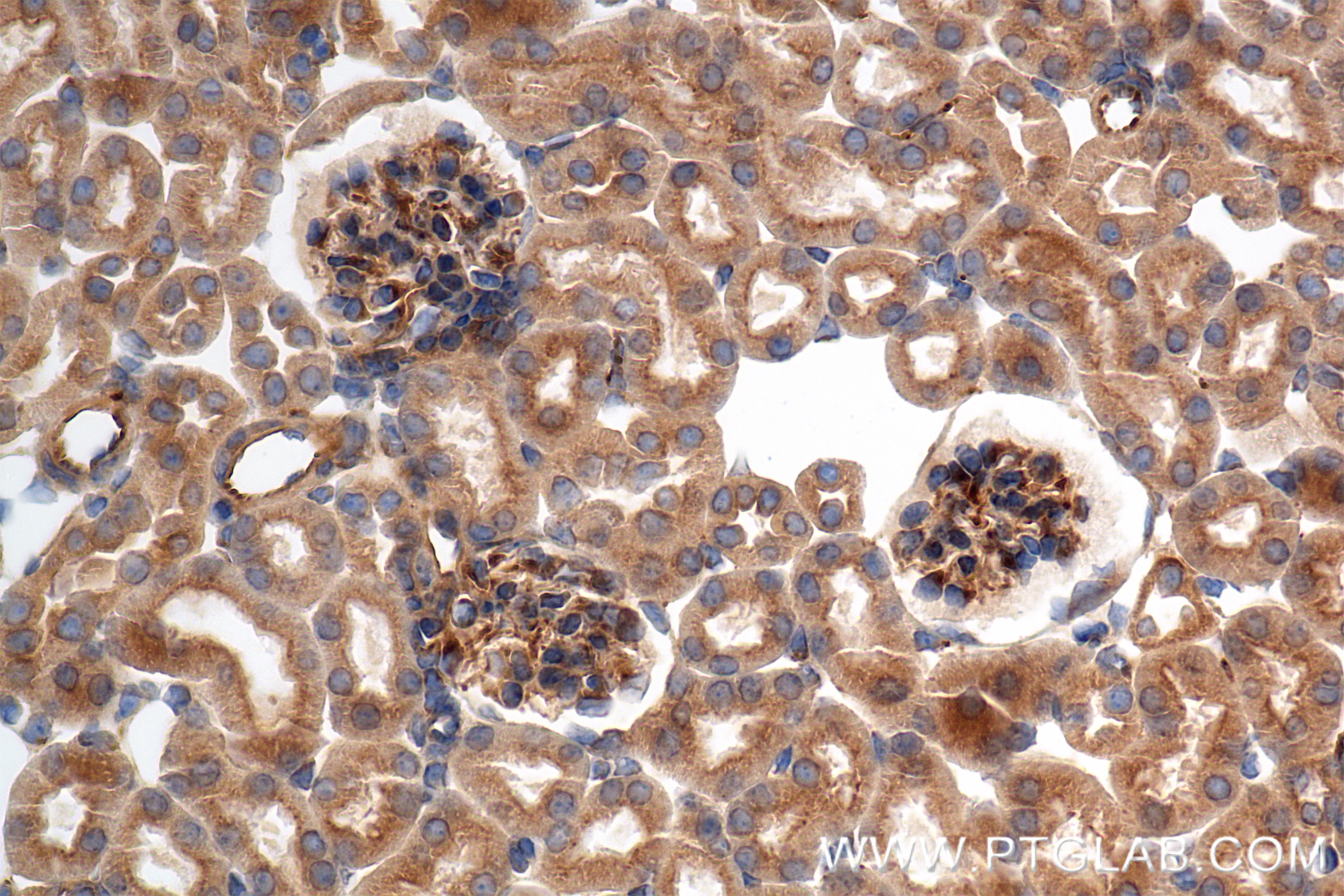 Immunohistochemistry (IHC) staining of mouse kidney tissue using FAM13A Recombinant monoclonal antibody, PBS Only (85092-1-PBS)