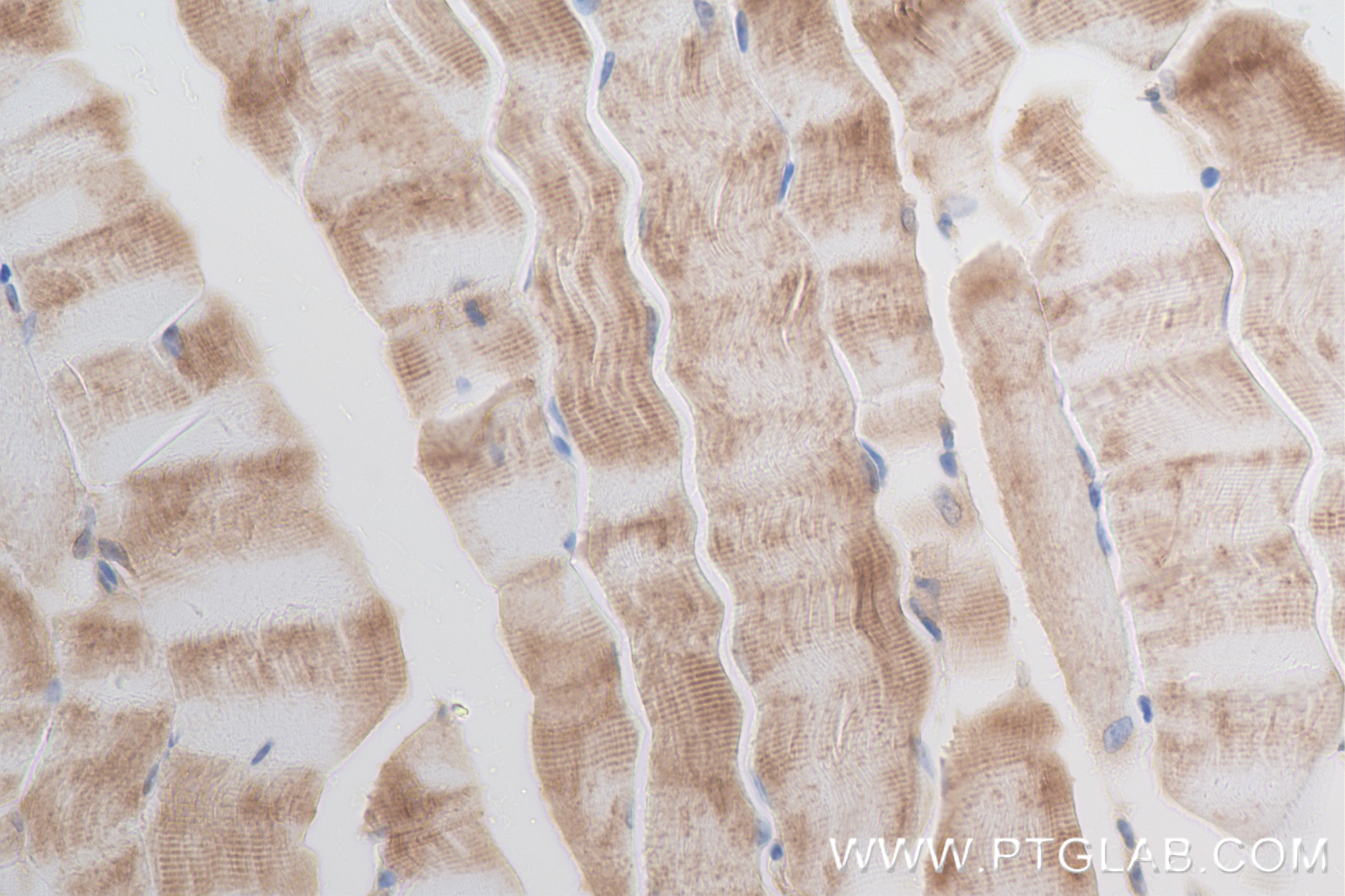 Immunohistochemistry (IHC) staining of mouse skeletal muscle tissue using FAM13A Recombinant antibody (85092-1-RR)
