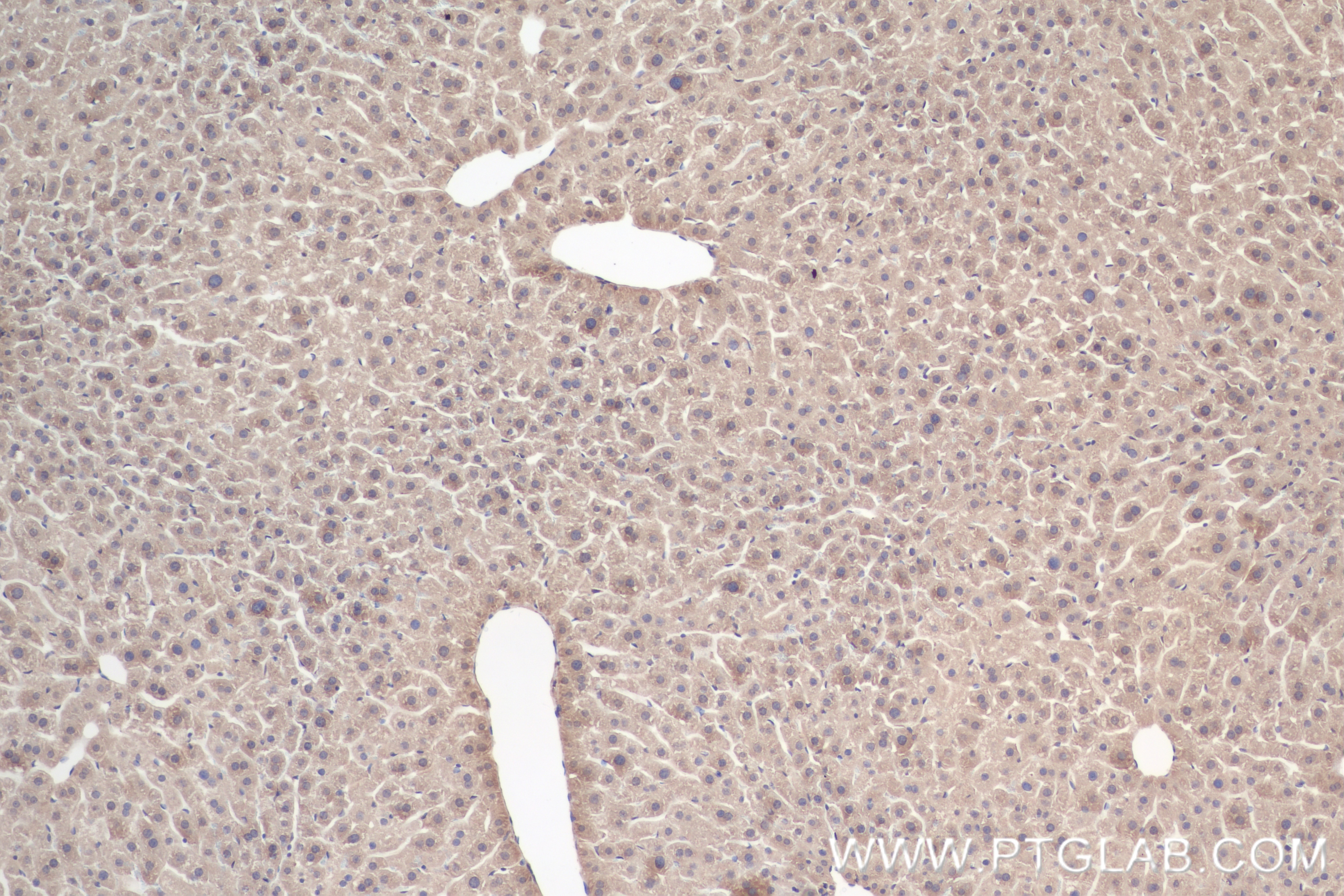 Immunohistochemistry (IHC) staining of mouse liver tissue using FAM13A Recombinant antibody (85092-1-RR)