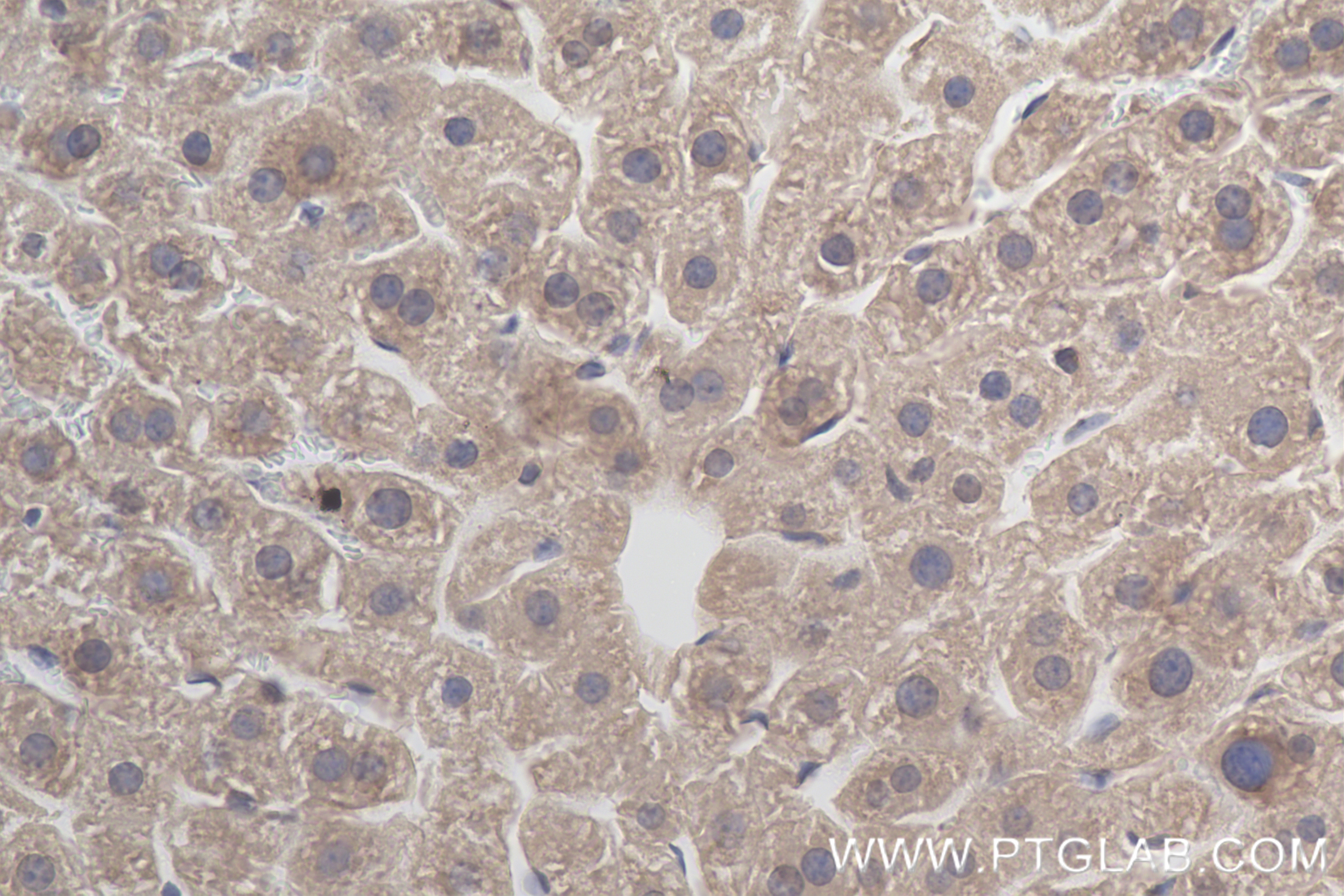 Immunohistochemistry (IHC) staining of mouse liver tissue using FAM13A Recombinant antibody (85092-1-RR)
