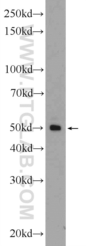 Western Blot (WB) analysis of K-562 cells using FAM155A Polyclonal antibody (24929-1-AP)